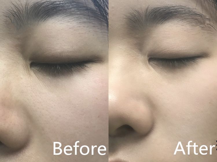 洁面仪luna同款,luna洁面仪平价替代