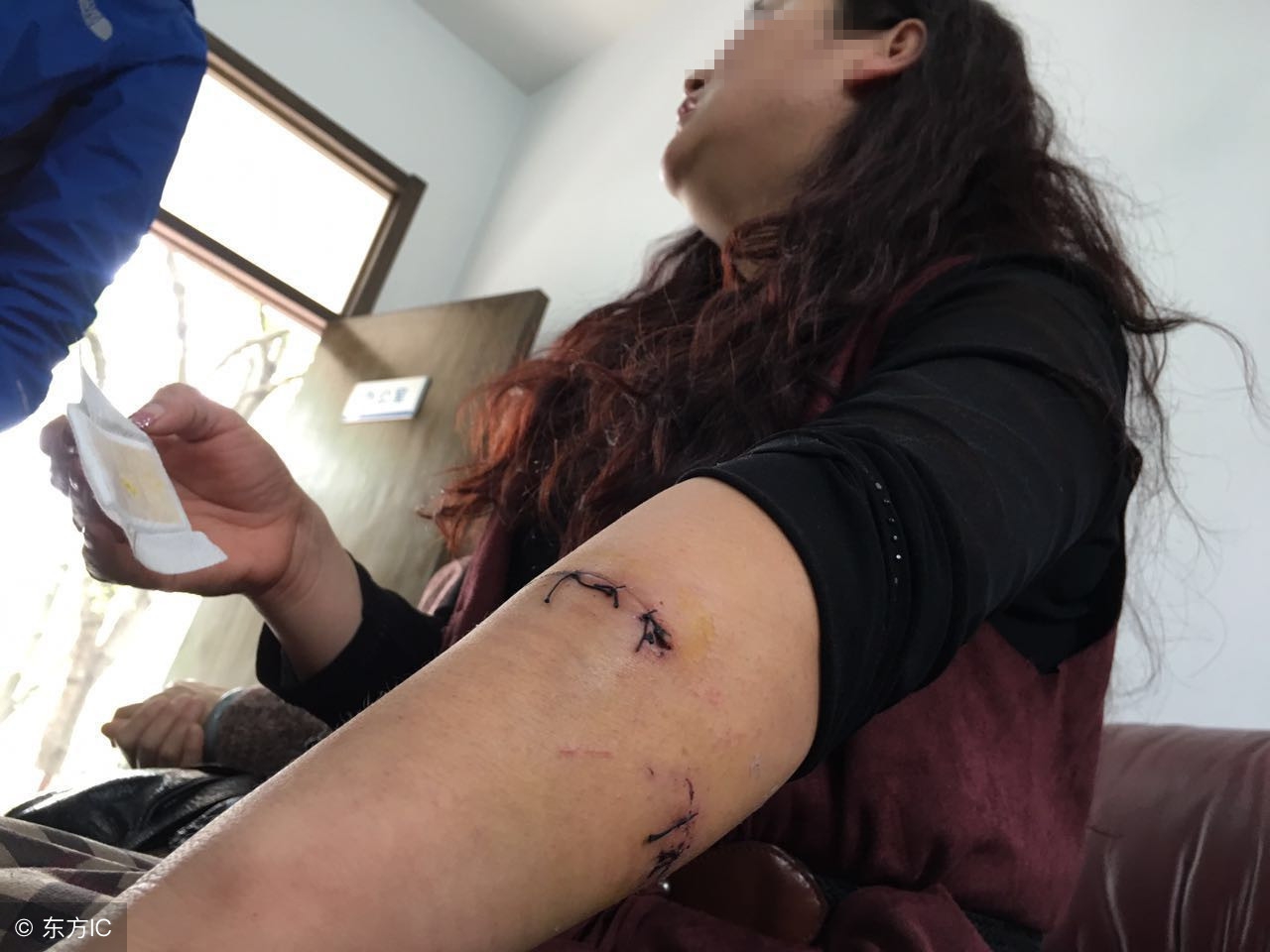 狗吃了火腿肠的铁环和皮,火腿肠加鱼钩狗吃了会怎么样