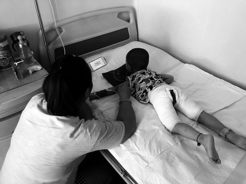 2岁宝宝被烫伤,2岁孩子被1000度开水烫伤