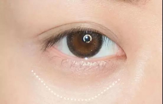 黑眼圈怎么遮眼袋,黑眼圈怎么遮瑕没有三文鱼色