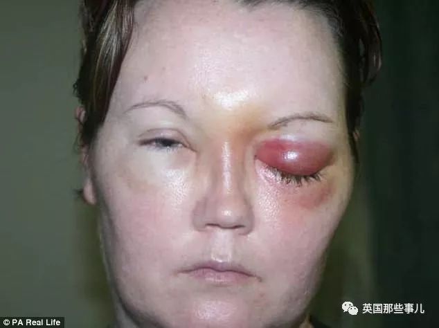 戴着隐形眼镜洗了一次澡,戴了隐形眼镜晚上还是看不清楚