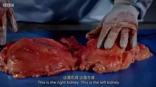 BBC解剖了一个200斤的女胖子，看完瑟瑟发抖！