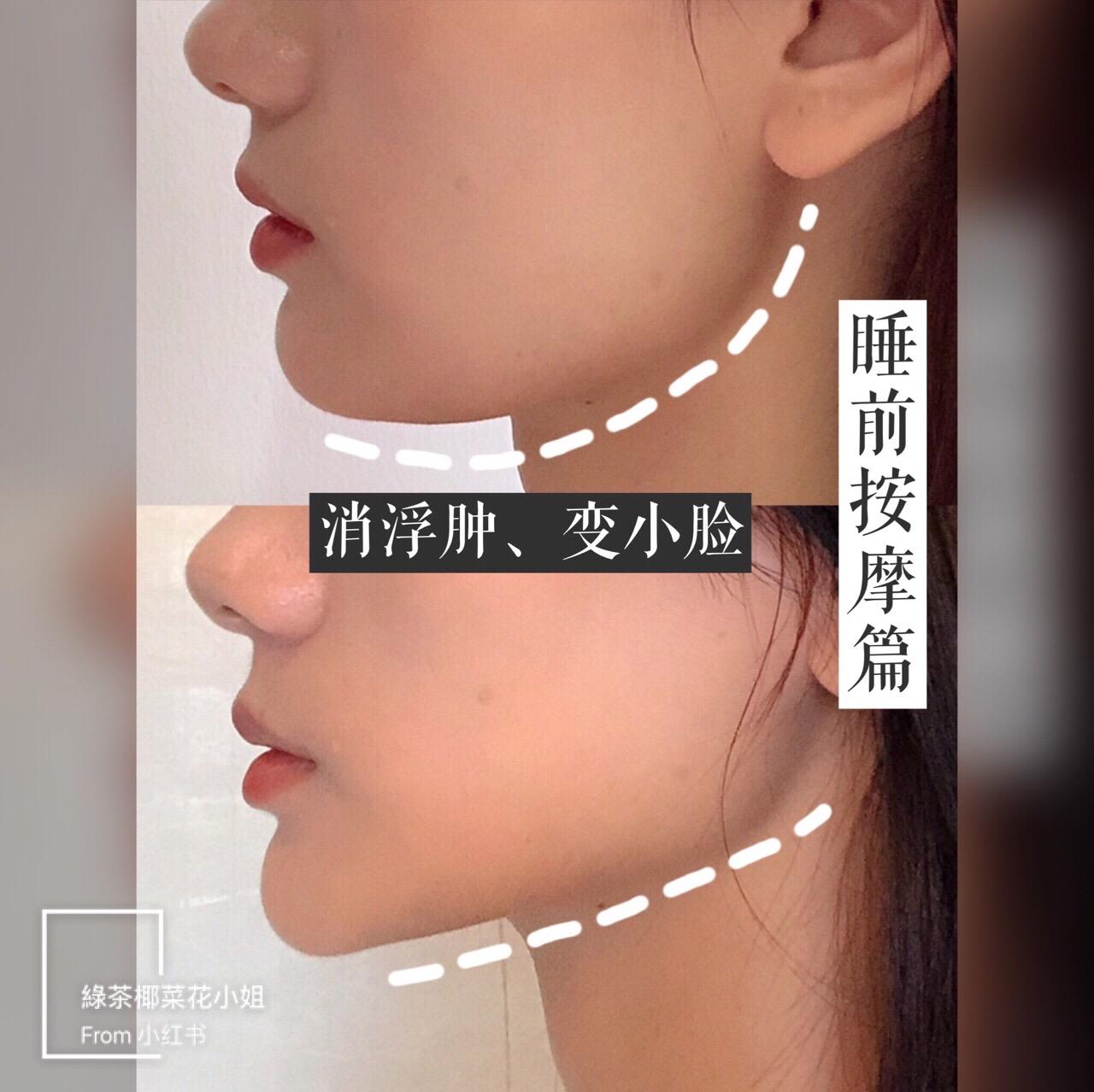 按摩消除下巴水肿的方法,消除脸部浮肿的操