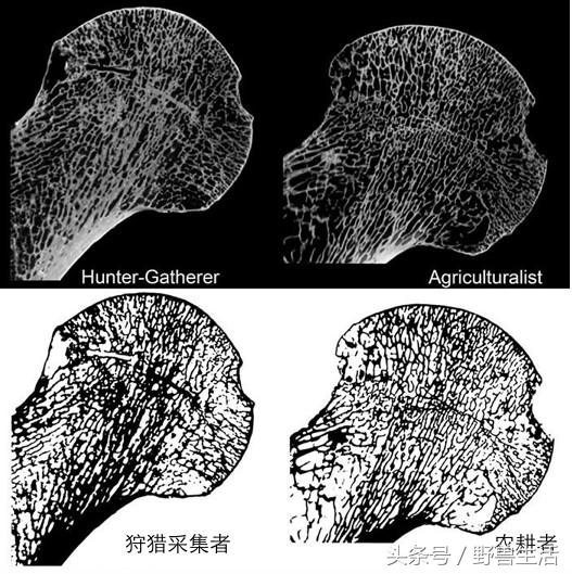 大脑退化不一定会脑萎缩,大脑贫血会有什么状况