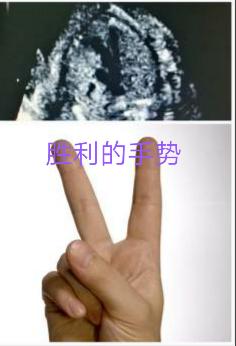 顺产的子宫为什么要流血,顺产后子宫有血怎么办