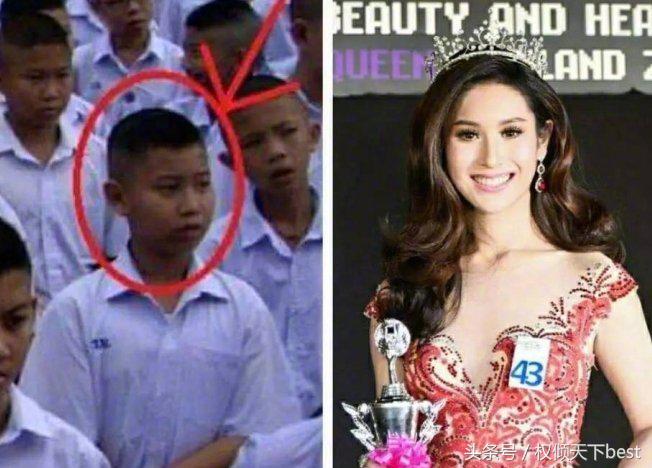 泰国人变性术前后对比,泰国的变性手术是什么原理