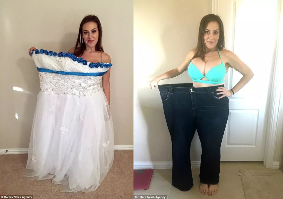 瘦了200斤,身体很多赘皮,怎么办?