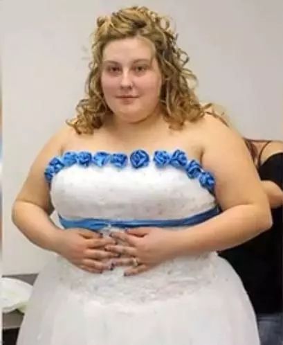 瘦了200斤，身体很多赘皮，怎么办？