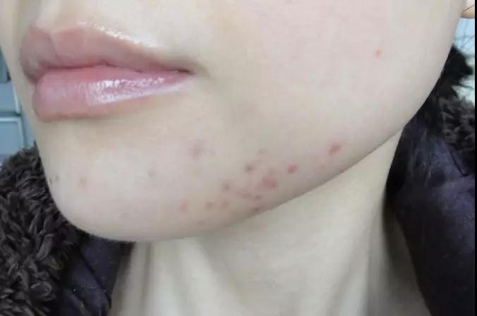 抗衰的误解有多深,抗衰的坑有多深