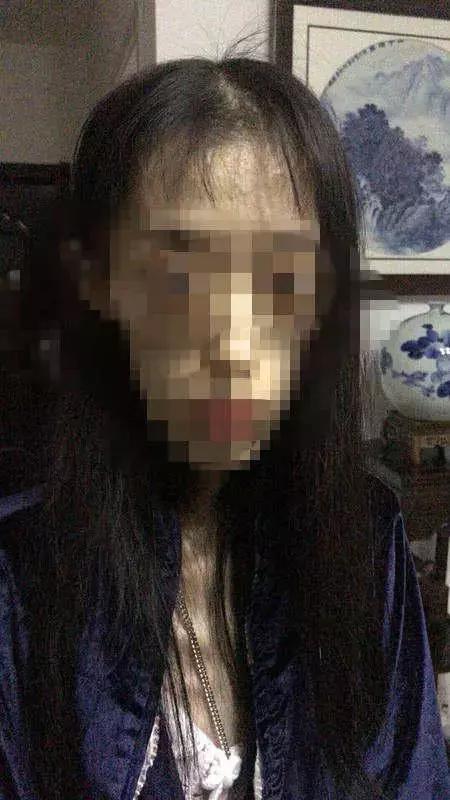 1米67才50斤，看到这个21岁女孩，你还敢“自杀式”减肥吗？