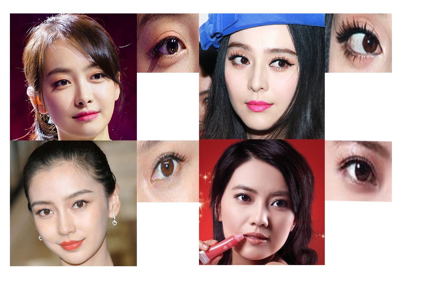 内眦赘皮要去整形医院吗,内眦赘皮怎么整形