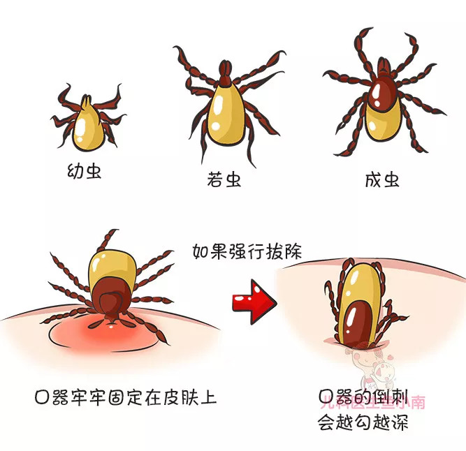 蜱虫咬在孩子头上怎么处理,宝宝如何预防蜱虫叮咬