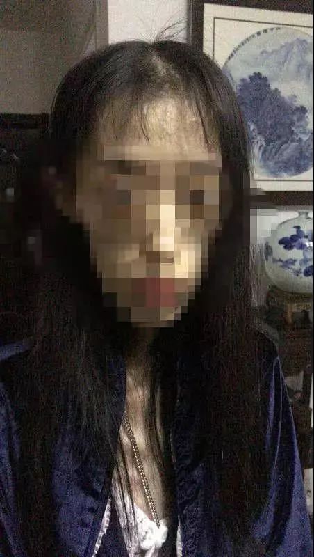 女子减肥脑组织减成60岁,1米7160斤瘦下来的真实案例