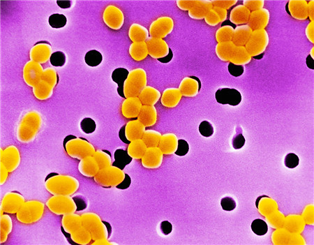 革兰氏阳性菌和革兰氏阴性菌选择抗菌药物