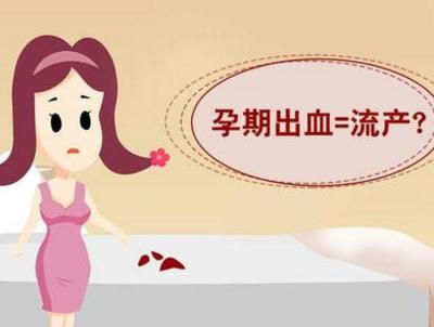 孕早期出血就是宫外孕吗,大量出血一定是流产吗