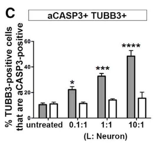 神经科学帕金森病,帕金森最终死亡原因