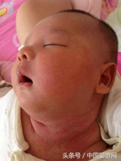 婴儿爽身粉使用注意事项视频教学,婴儿爽身粉使用注意事项视频