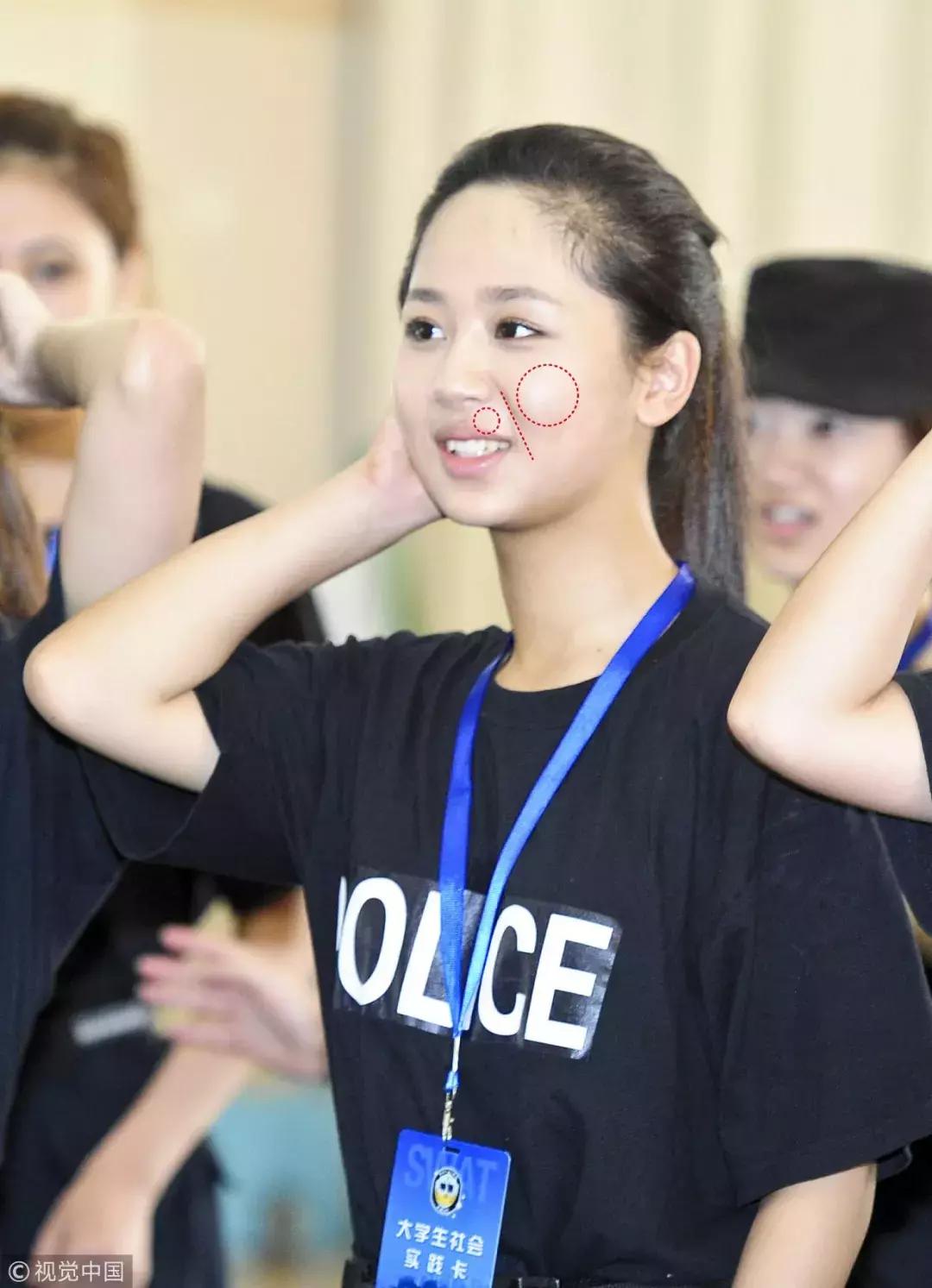 除了发量,最暴露年龄的可能是这两道纹