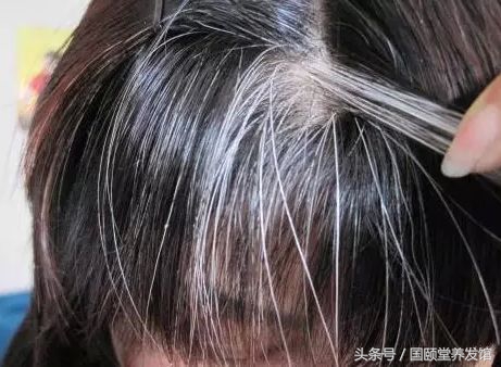 国颐堂养发馆防脱生发效果怎么样,国颐堂养发骗局揭秘