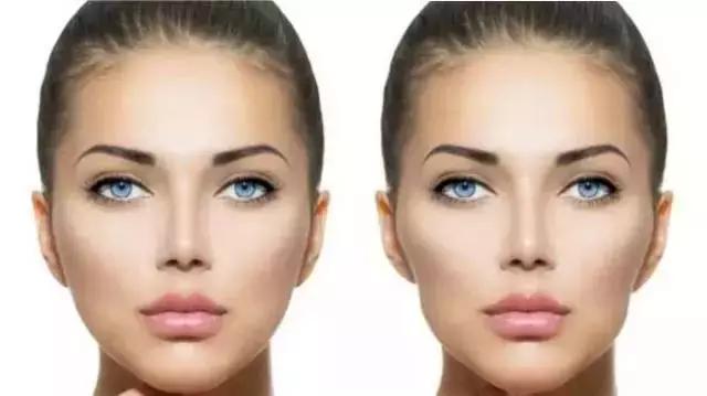 还在犹豫是否整牙，明星们默默变美都在靠它，你想知道的这篇都有