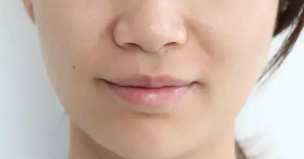 vc精华淡化法令纹暗沉,vc用了法令纹发黄