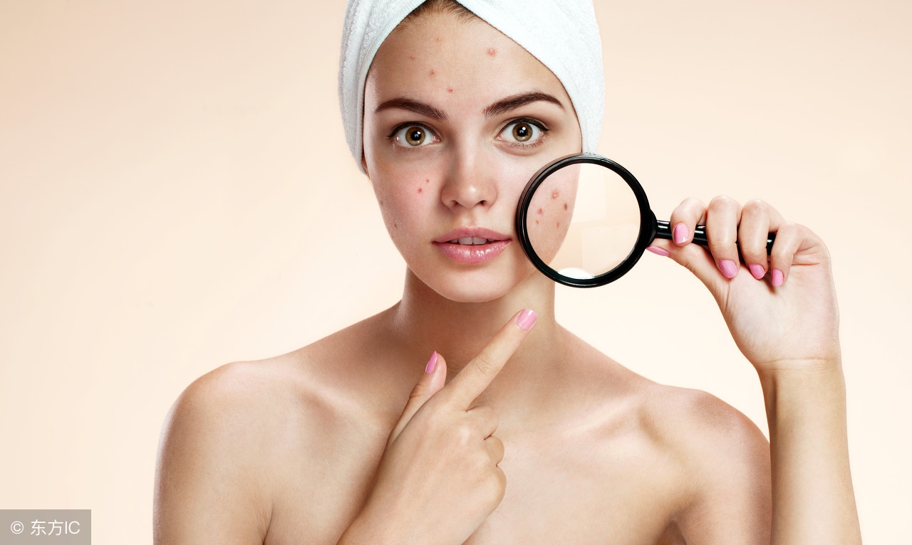 刷酸真的能解决痘痘问题吗,刷酸改善痘痘测评