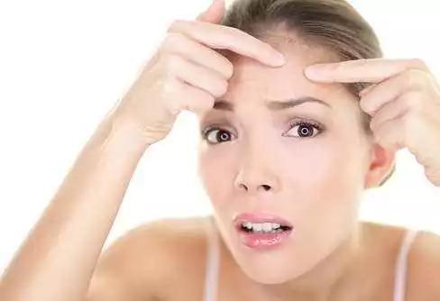 闭口痘痘推荐药膏,治疗粉刺闭口痘印药膏