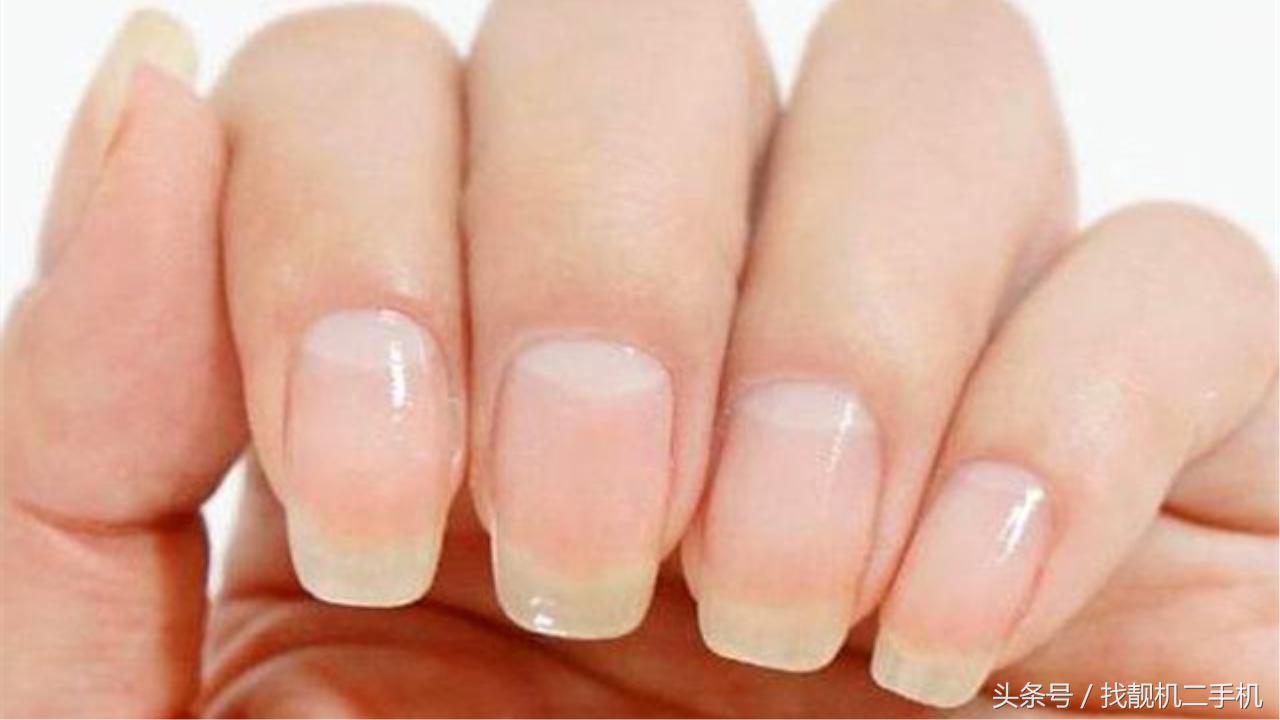 手指上没有月牙代表什么意思,十个手指都没有月牙这说明什么