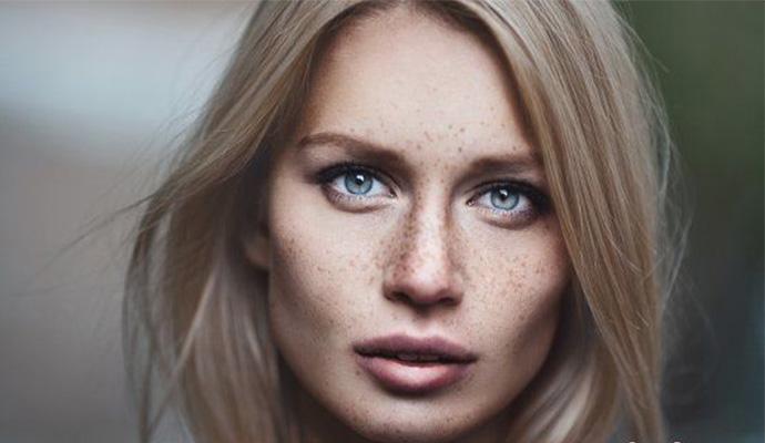 脸颊两侧长斑是什么原因？你的色斑什么时候能去掉？