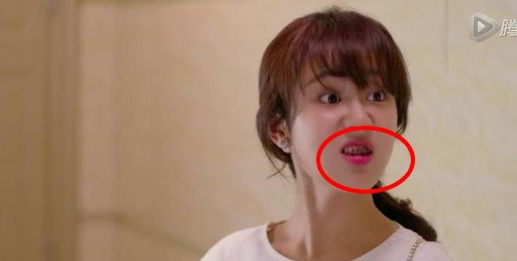 牙周炎最新治疗技术,牙周炎是怎么引起的