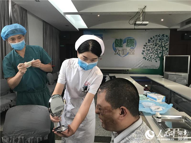 武汉帅气小伙整容成轻微面瘫,武汉男孩被烧伤