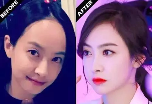 修理发际线男士,男生要不要修发际线