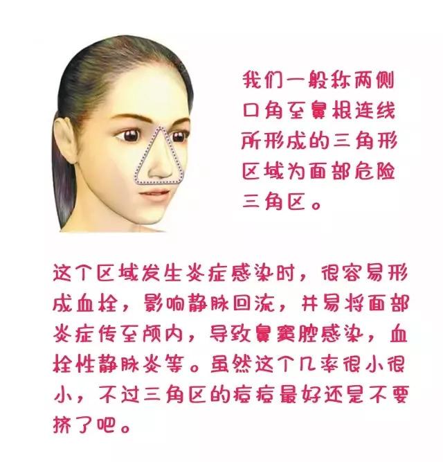 脸上痘痘贴什么遮住,痘痘贴消炎最快方法