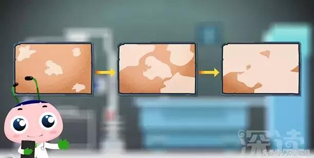 海边游泳晒红了怎么补救,海滩游泳后皮肤起红点