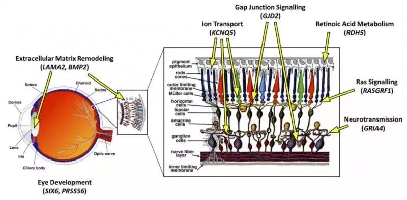 防控近视眼的要点,防控近视眼镜怎么样