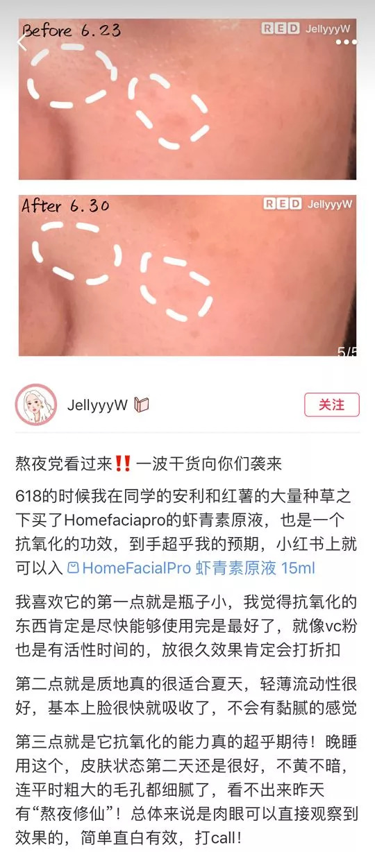 还嫌自己脸黄？推荐好用到逆天的国货精华，不到百元就能提亮肤色！