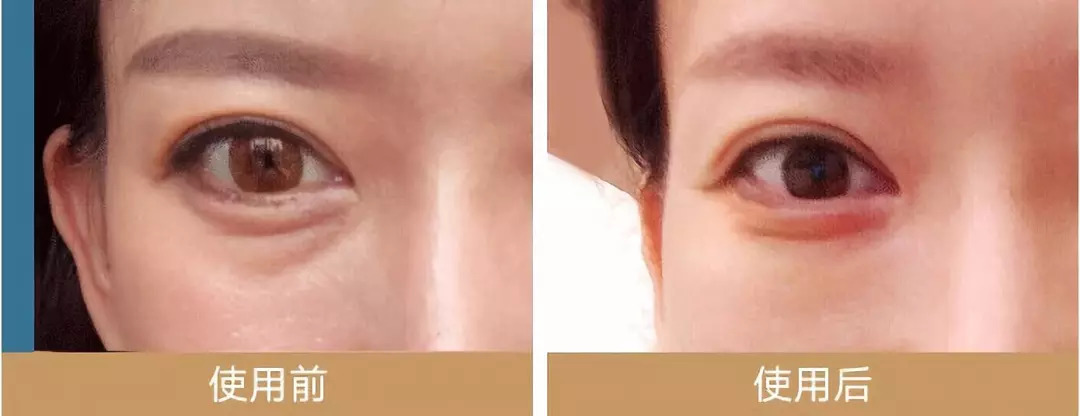 外用中药眼膜,中药眼膜去眼袋眼纹