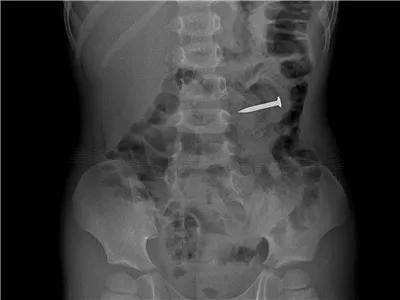 一些让人毛骨悚然拍到的照片,六个令人毛骨悚然的影像