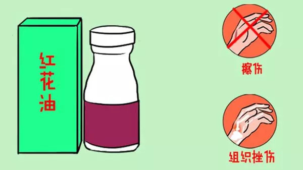 紫药水、红药水、酒精、碘伏……哪种处理伤口好？你可能一直都用错了