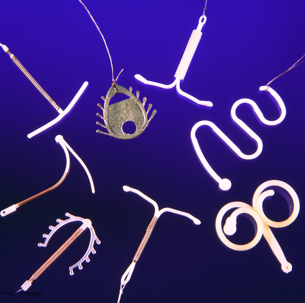 节育环哪种副作用最小,节育环哪种不容易炎症