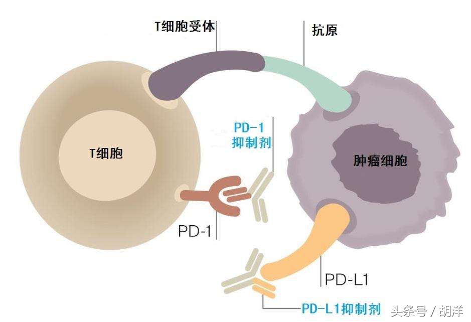 有没有黑色素瘤晚期治愈的人,黑色素瘤国内治愈案例
