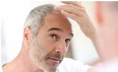 怎么样可以让白头发变黑,有什么办法能使白头发变黑