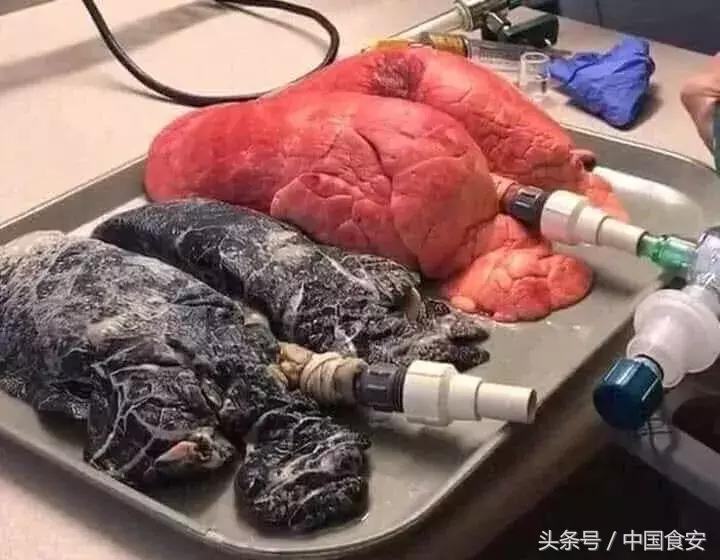 比香烟毒七倍致癌吗,比香烟危害小的电子烟