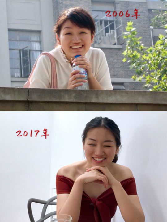 童颜机tripollar宙斯,童颜机tripollar溶脂