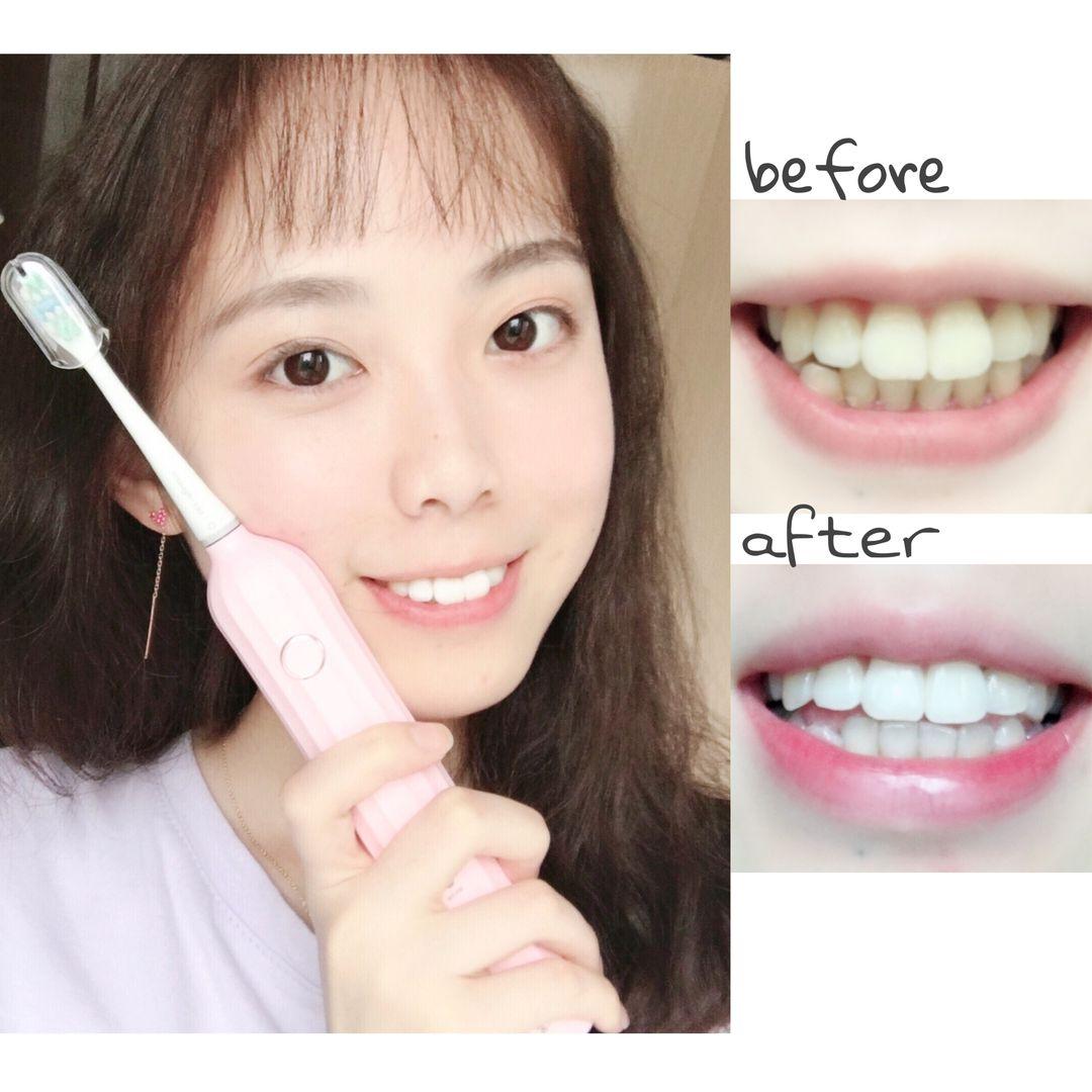 比较有效的牙齿美白方法,牙齿美白小窍门知乎
