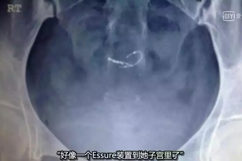 美国医疗界的黑幕,触目惊心!