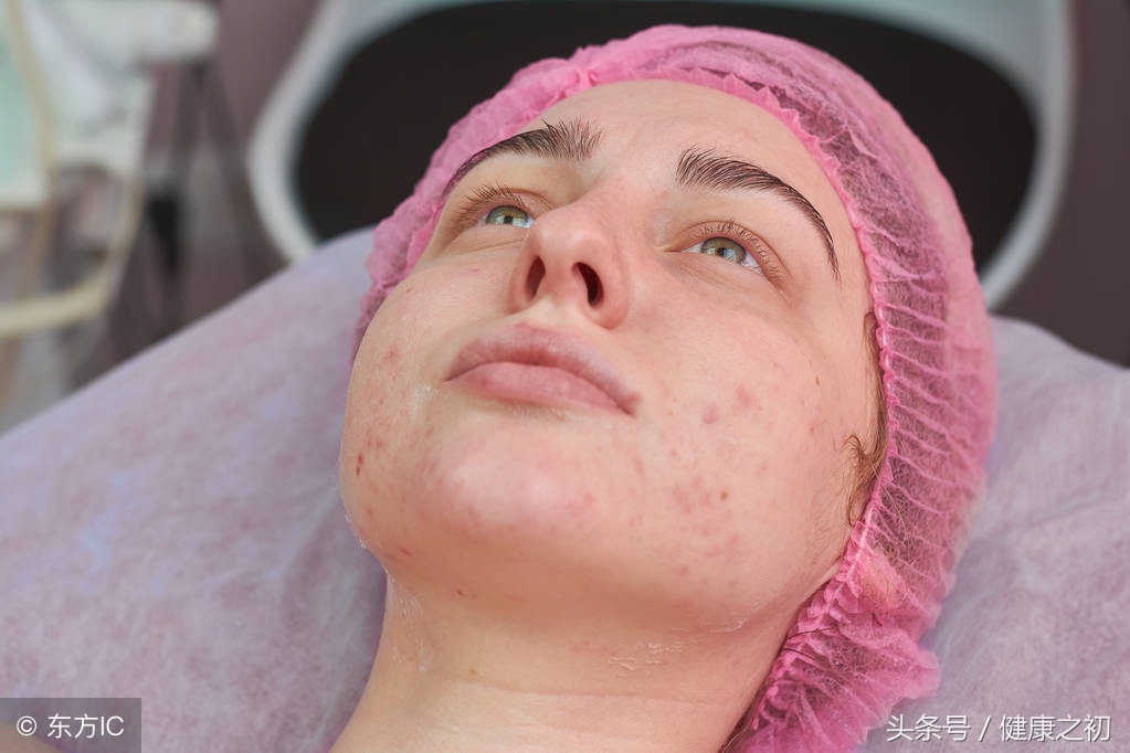 为什么化妆品过敏需7-14天,为什么化妆品过敏了要退回去