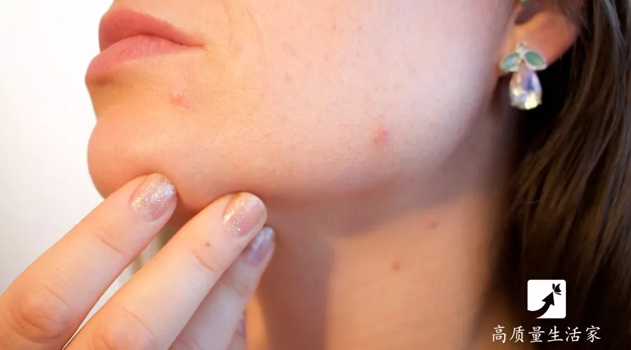 阿司匹林抹脸,阿司匹林片碾碎能洗脸吗