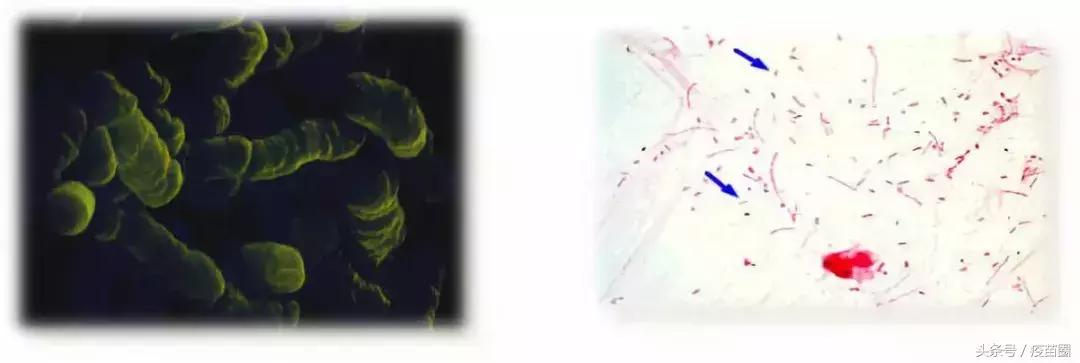 b型流感嗜血杆菌和hib一样吗,hib流感嗜血杆菌预防哪种疾病