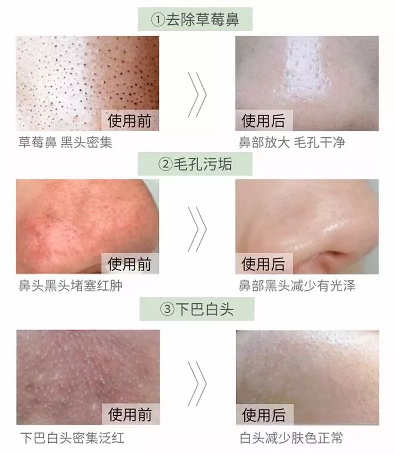 脸上污垢,脸上的脏东西真能清理出来吗